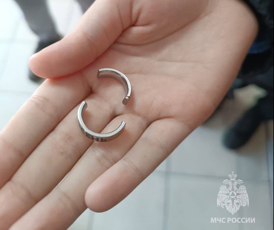 Спасатели высвободили палец юной калининградки от кольца