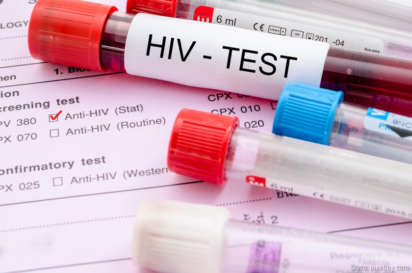 За неделю у 10 калининградцев диагностирована ВИЧ-инфекция