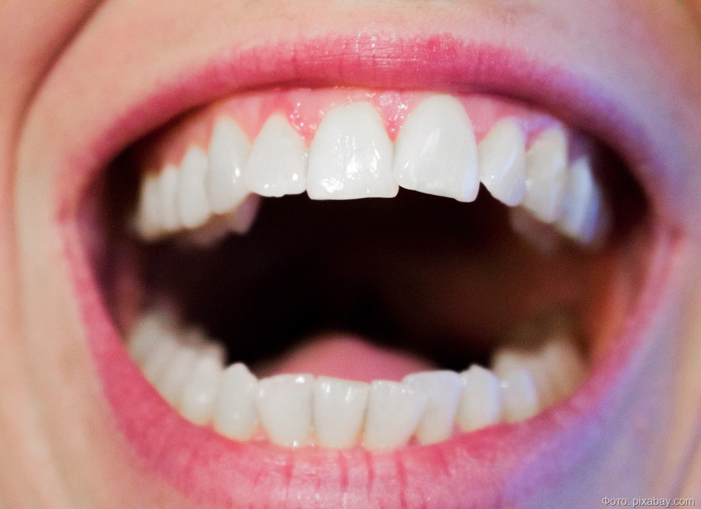 teeth-1652937_1280 teeth-1652937_1280